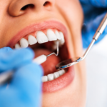 Microchirurgie endodontique guidée : le microscope, le CBCT et le guide 3D s’allient pour sauver votre dent en 2026