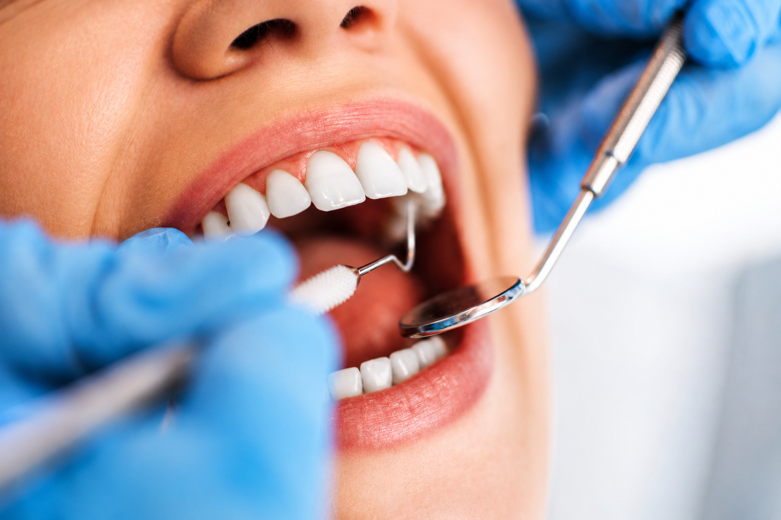 Microchirurgie endodontique guidée : le microscope, le CBCT et le guide 3D s’allient pour sauver votre dent en 2026