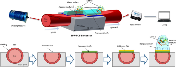 Prélèvement salivaire pour diagnostic salivaire dentaire dans un cabinet moderne avec analyse du microbiome oral à l'écran